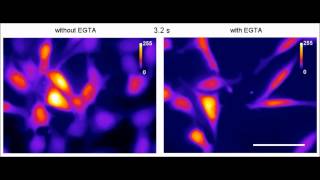 Investigation of Biophysical Mechanisms in Gold Nanoparticle Mediated Laser Manipulation of Cells...