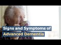 Signs and Symptoms of Advanced Dementia