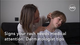 Signs your rash needs medical attention: Dermatologist tips