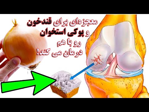 معجزه‌ای برای قندخون و پوکی استخوان رو با هم درمان می کند!