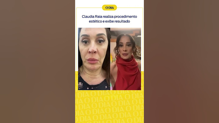 Claudia Raia realiza procedimento estético e exibe resultado | Notícias do Dia