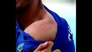 Luis Suarez Bite vs Italy on Chiellinia (Italy vs Uruguay - 24/06/2014)