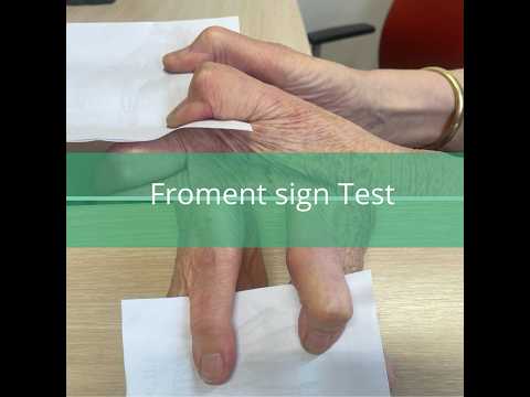 Froments Test explained