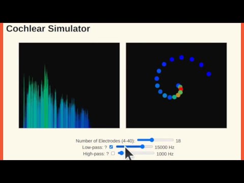 Explore the Cochlear