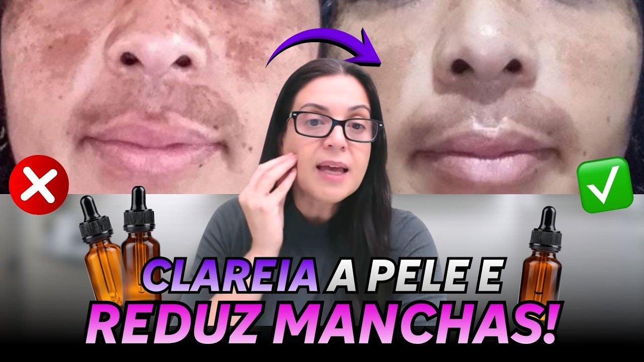 Melhores Óleos Essenciais que clareiam manchas e uniformizam a pele