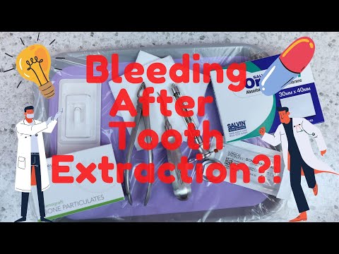 What to do to stop bleeding after tooth extraction?! / How to control bleeding after extraction?!