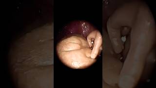 Baby’s inside the womb new imaging technology ultrasound #reactionvideo #crazyshorts #facts