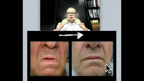 Porque quando eu sorrio meus dentes não aparecem?