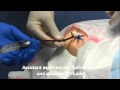 Pulmonary Artery (Swan Ganz) Catheter Insertion