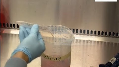 Mammosphere Formation Assay from Human Breast Cancer Tissues and Cell Lines