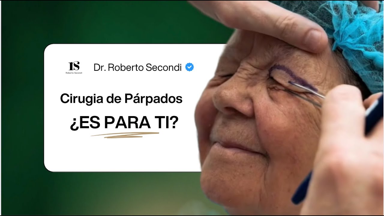 Cirugía de Párpados en 2026: Lo Que Todo Paciente Debe Conocer