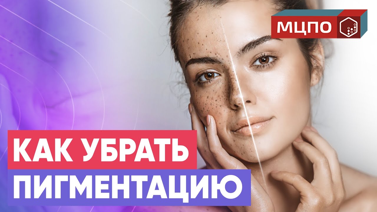Как убрать пигментные пятна? Самый правильный и эффективный способ. Курсы косметологов в МЦПО