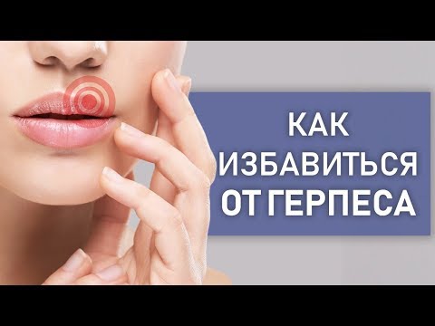 Как избавиться от герпеса? Консультация ДЕРМАТОЛОГА