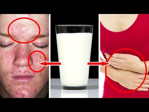 Learn Why Milk Could Be Killing You