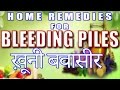 Home remedies for bleeding piles haemorrhoids ii     ii