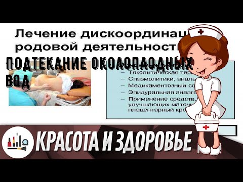 Подтекание околоплодных вод