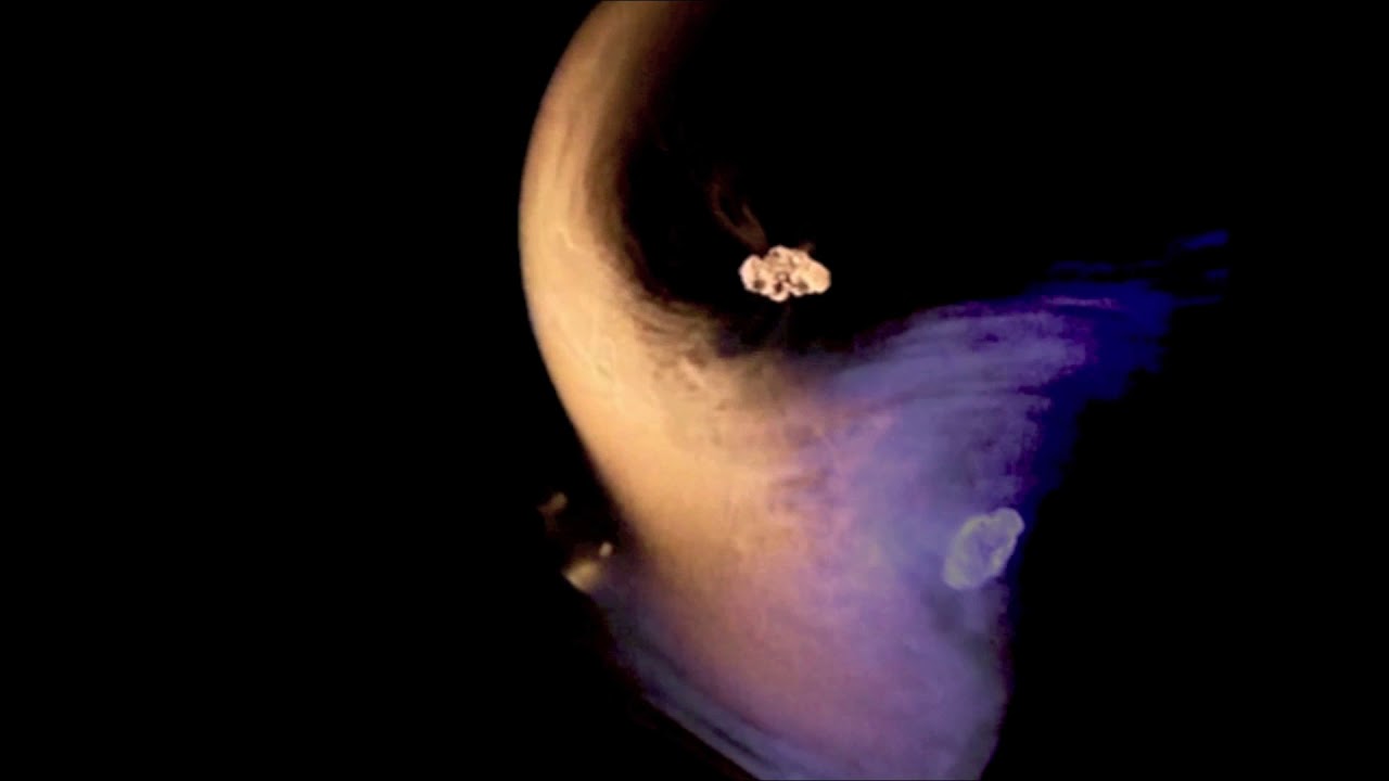 Under Dead Elms Excerpt