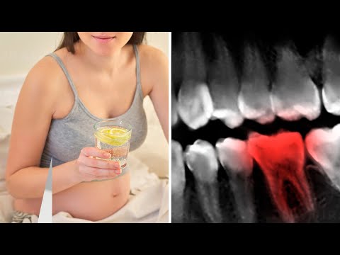 Lemon Water Is Destroying Your Teeth, Here Is How To Fix It!