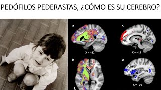 Perfil neurocriminológico del pedófilo pederasta