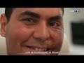 Épithésiste : l'art de reconstruire avec des prothèses en silicone les visages de patients｜TF1 INFO