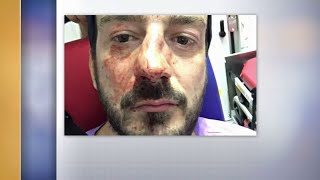 "J'ai vu mon nez explosé." Le président d'Urgence Homophobie témoigne de son agression