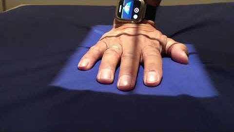 How To Take A Hand X-Ray Perfectly - Every Time!!!