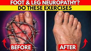 The Only 6 Exercises You Need To Relieve Neuropathy In Feet Legs