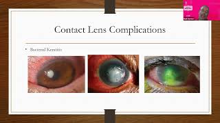 Information Contact lens webinar News