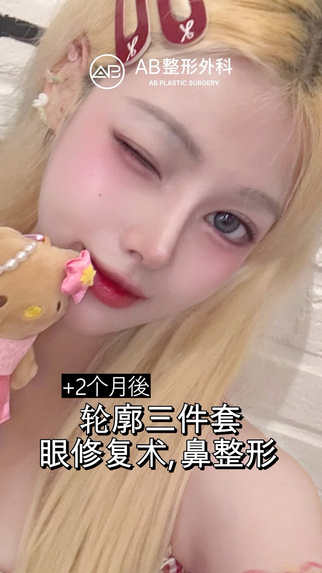 正面側臉都超神！整形後美到不敢信 #shorts