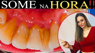 Zero Tártaro E Mau Hálito 3 Receitas Infalíveis Para Remover O Tártaro E Mau Hálito Dos Dentes