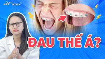 Niềng răng có đau không: giai đoạn nào "đáng sợ" nhất? (chú ý giai đoạn 3)