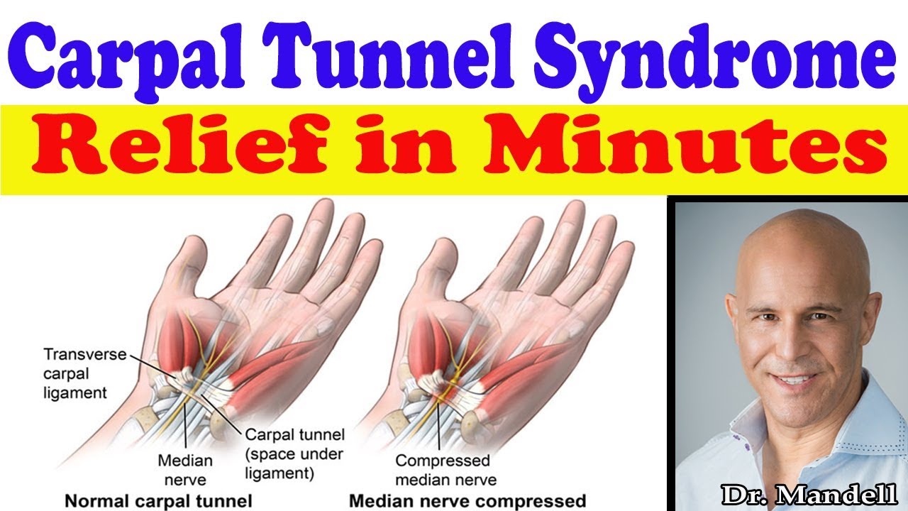 Csuklótáji alagút szindróma (Carpal tunnel syndrome)