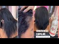 ANAMNESE CAPILAR | tratamento para cabelo ressecado e com queda