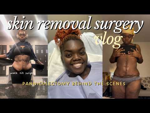 I HAD SURGERY! skin removal surgery after MASSIVE weight loss!
