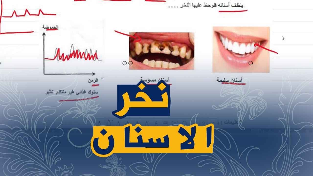 وضعية ادماجية على نخر الاسنان علوم طبيعية السنة الرابعة متوسط