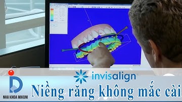 Niềng răng không mắc cài Invisalign | Nha Khoa MIKUNI