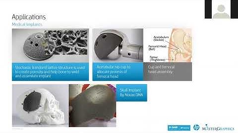 Practical uses of lattice structure design for TPU