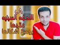 اللدغه السينيه او اللثغه السينيه و اشكالها وطرق علاجها بسهوله علاج لثغه السين