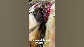 Could You Handle This Being Your Foot This Cows Hoof Is Now MUCH Better 