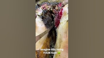 Zou jij dit als jouw voet kunnen verdragen??? De hoef van deze koe is nu VEEL beter!!