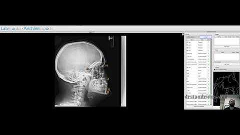 Quick Ceph Tracing in Blue Sky Plan