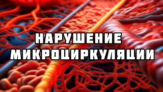 картинка: Нарушение микроциркуляции // Патофизиология (2 тема)