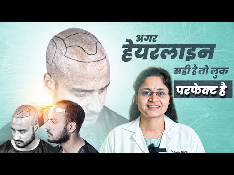 Why a Perfect HAIRLINE Matters for Your Personality 🧐 | Hindi