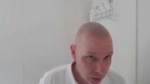 Video Testimonial - Stuart - Scalp Micro Scotland