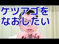 ケツアゴを自分で治したい