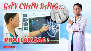 GÃY CHÂN RĂNG PHẢI LÀM SAO???? |Dr Cường Offical