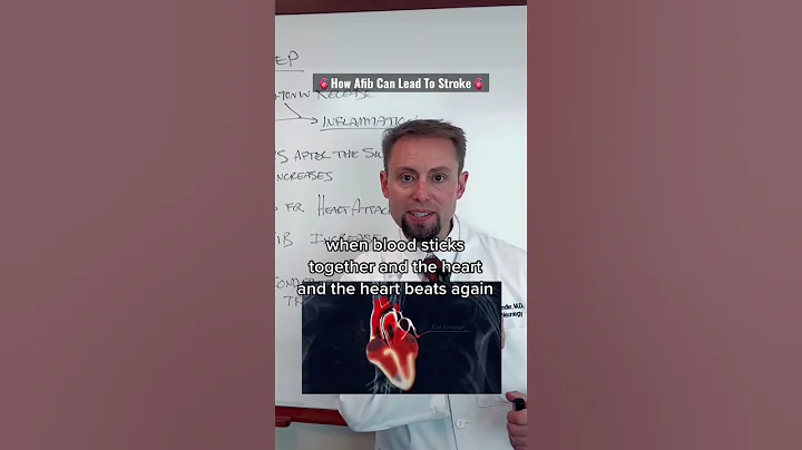 Doctor Describes How Afib Can Lead To Stroke.