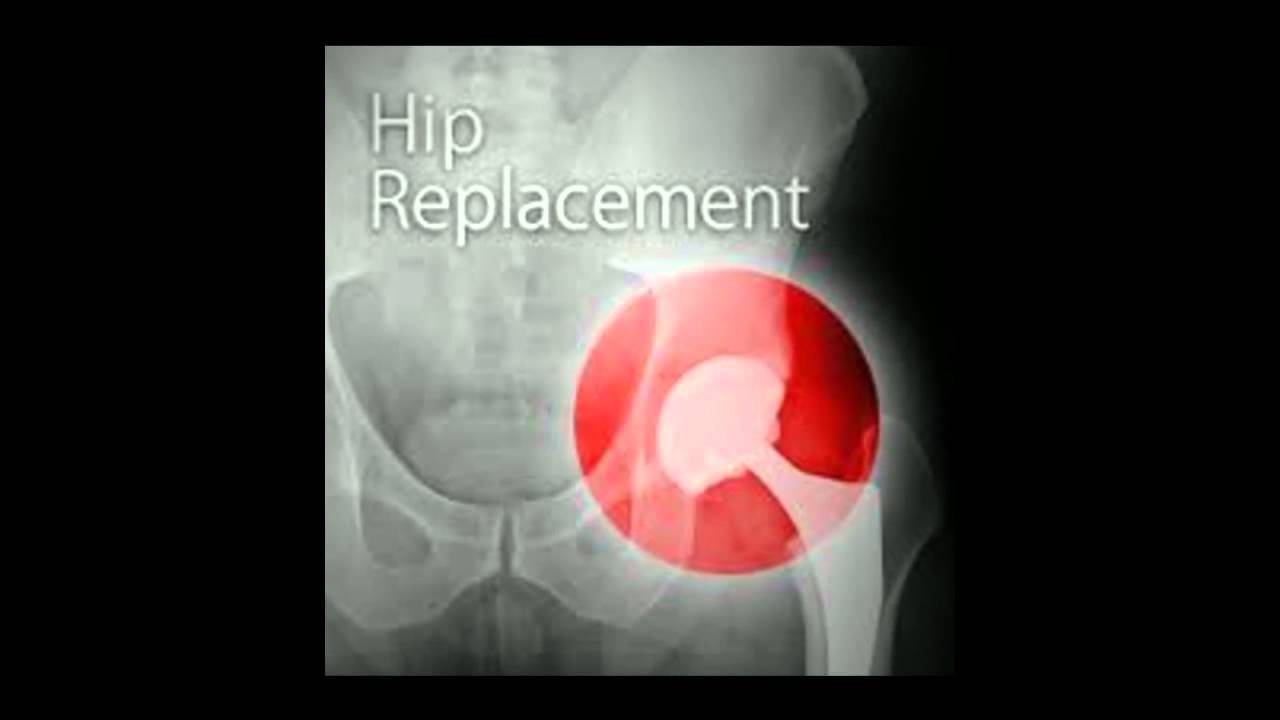 Let Depuy Hip Recall Lawyer represent you!