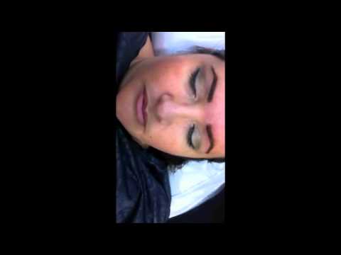 Video thumbnail: aida brow procedure