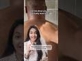 You can actually get rid of all back acne,butt acne or body acne with this #bodyacne #acne #backacne